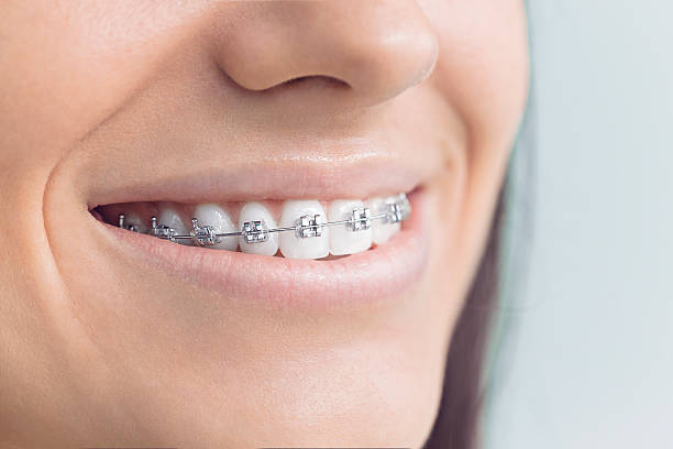 Laser Dentistry in Panther Valley, NJ